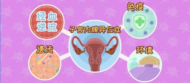 20191224_1577154315_.jpg 子宫内膜异位症.jpg