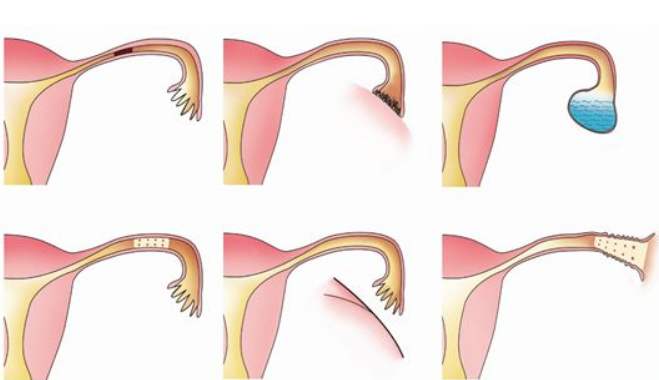 20200107_1578367289_.jpg slg.jpg