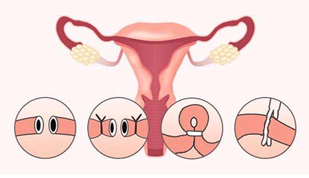 20200111_1578710649_.gif m.gif