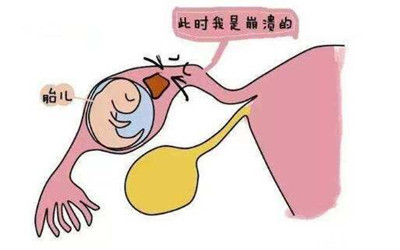 20200513_1589336519_.jpg 2-1PP31J409400.jpg