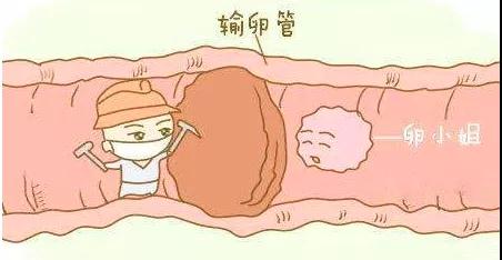 子宫内膜异位症早期症状 子宫内膜异位症早期症状