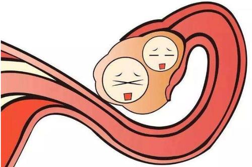 深圳光明包皮微创手术一般多少钱 深圳光明包皮微创手术一般多少钱