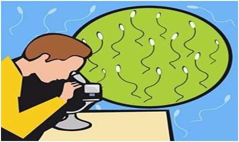 精索静脉曲张 精索静脉曲张