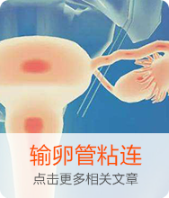 输卵管粘连