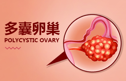 应该怎样预防多囊卵巢呢