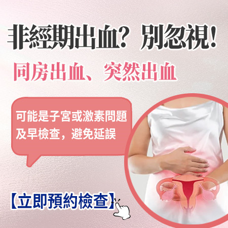 子宮頸息肉