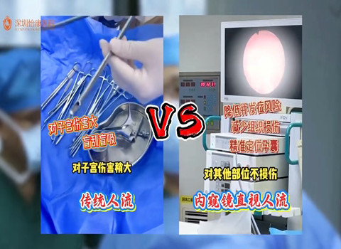 無痛人流痛唔痛